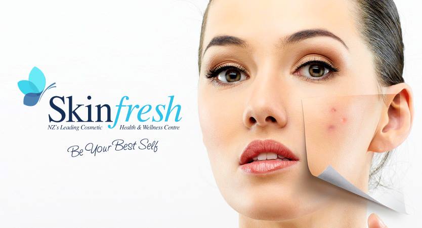 CLEAR UP ACNE OR BLEMISHES 1