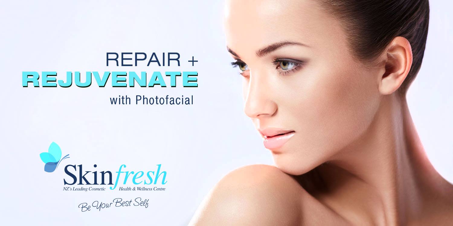 PHOTOFACIAL 1