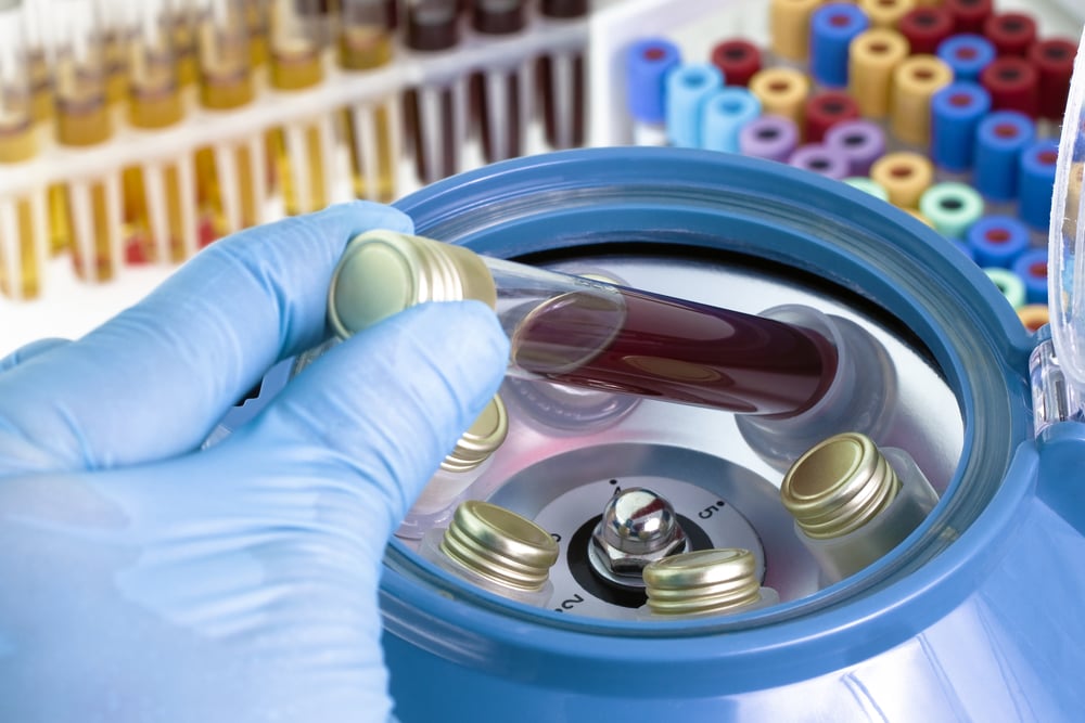 Centrifuging blood DP